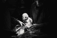 Having a c-section? Here's what you can expect